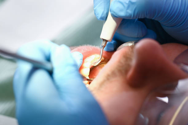 Best Broken or Cracked Tooth Emergency Dentist in Lake City, SC