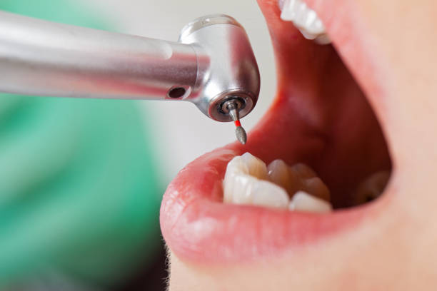 Best Emergency Dental Services for Seniors in Lake City, SC